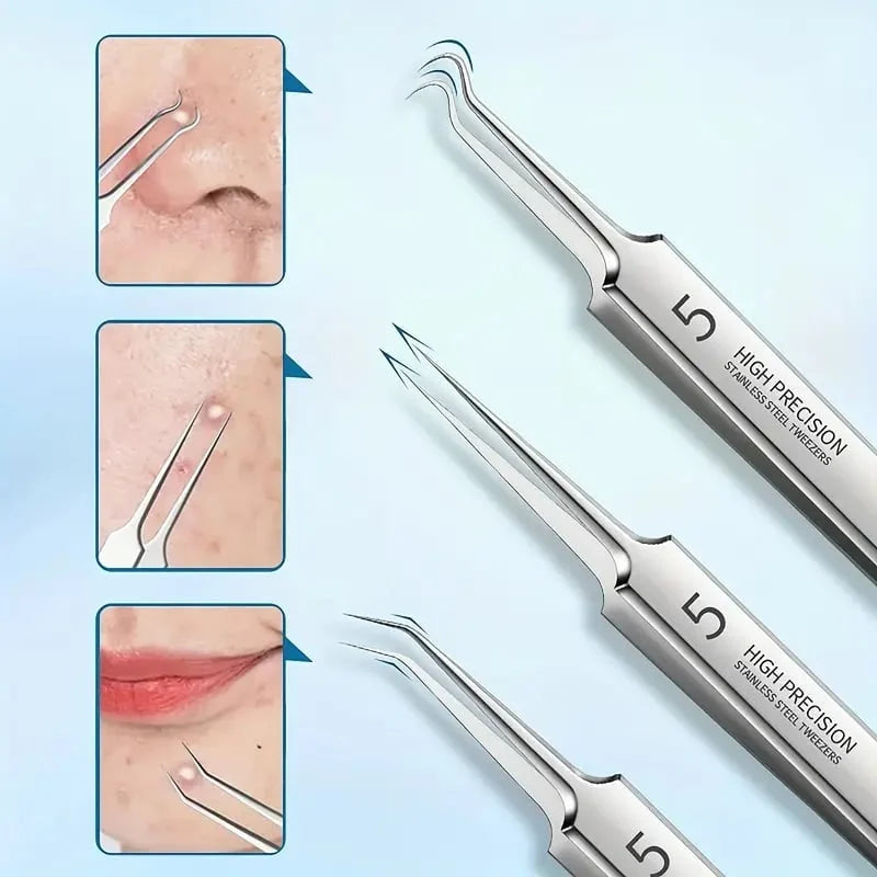 Extracteur de points noirs clinique