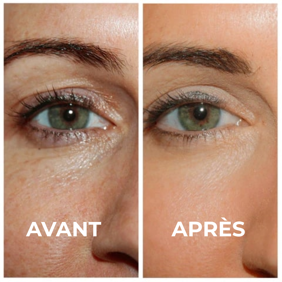 Gel Contour des Yeux Raffermissant Professionnel