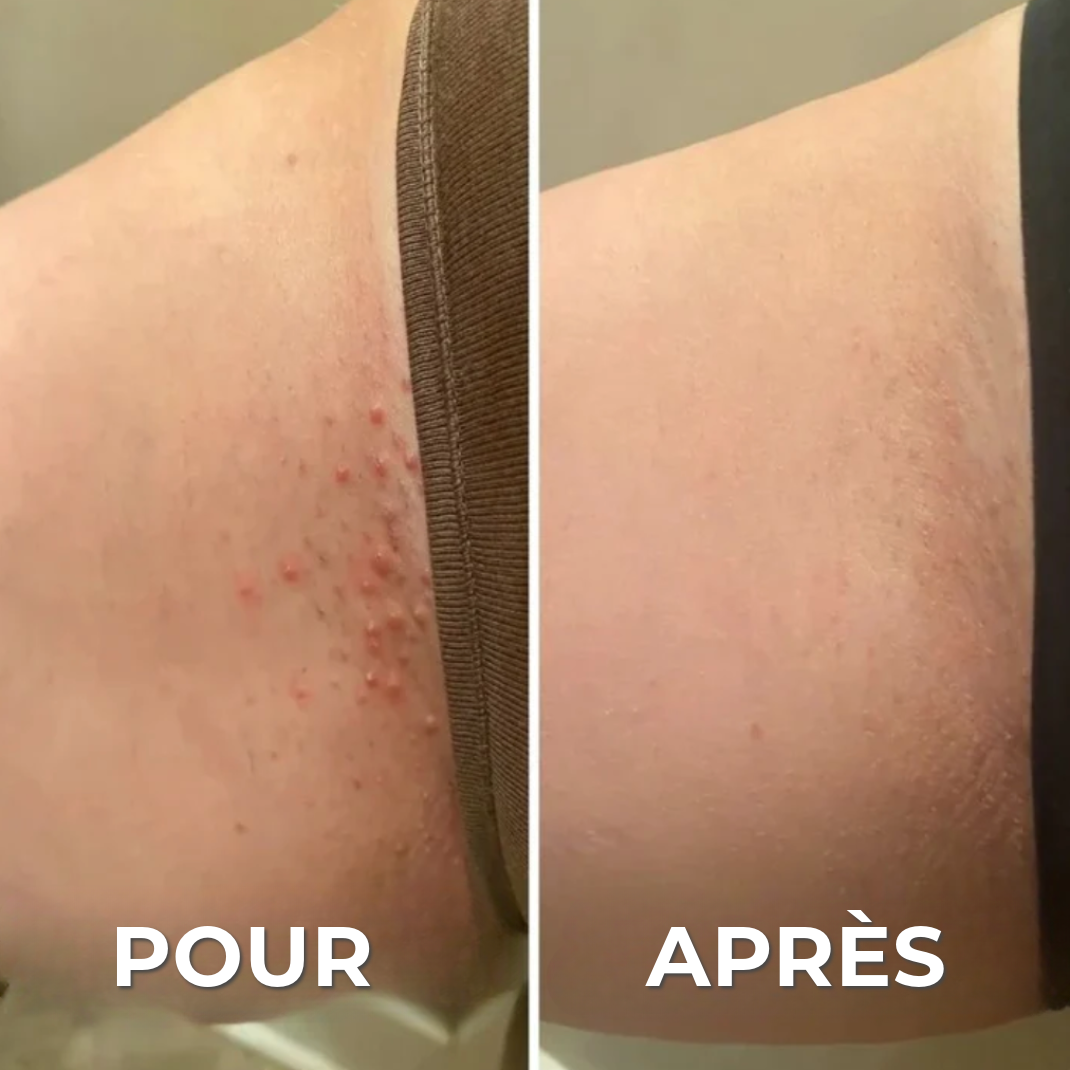 Rasoir professionnel anti-irritation