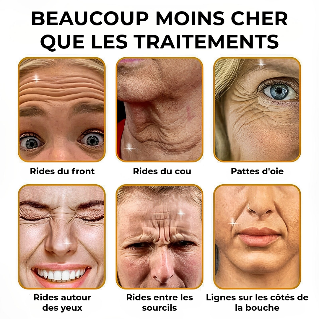 Crème Anti-Rides BOTOX™