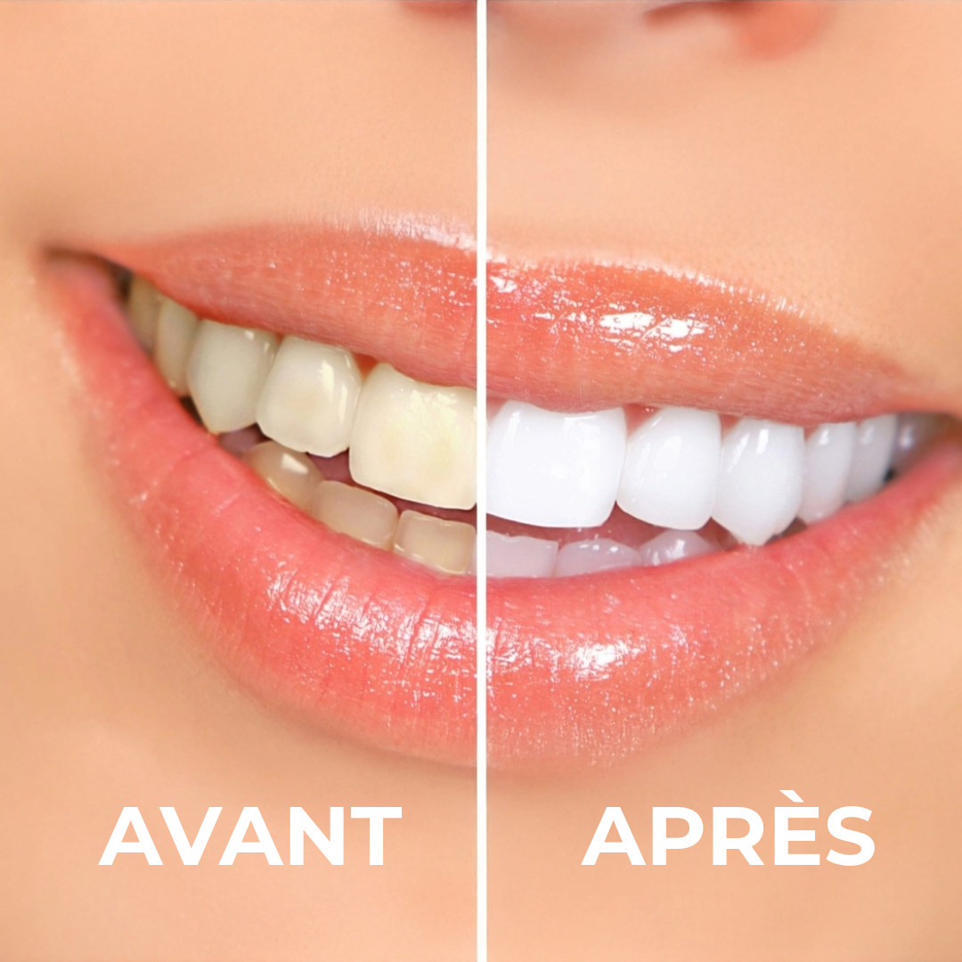 YouBuy™ | Poudre Blanchissante Professionnelle pour les Dents