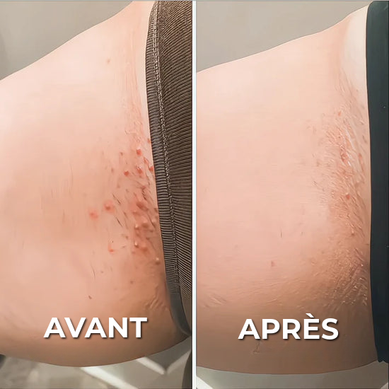Rasoir Professionnel