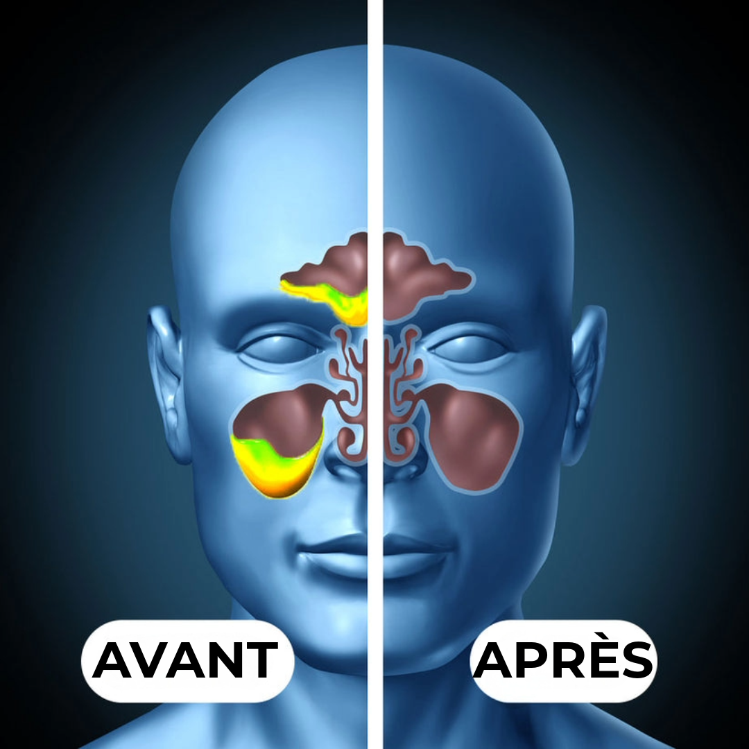 Nettoyeur Sinus Professionnel