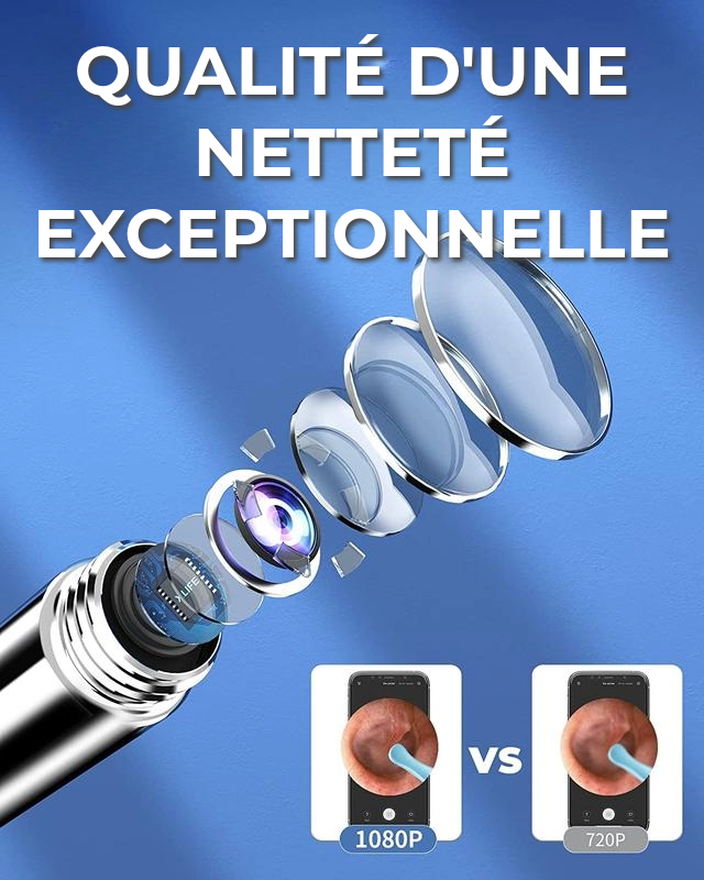 Nettoyeur d'Oreilles Professionnel | Ensemble de 8 Pièces