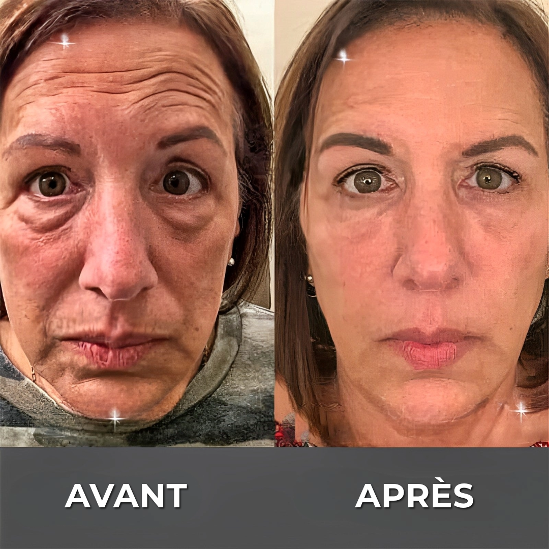 Crème Anti-Rides BOTOX™