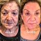Crème Anti-Rides BOTOX™