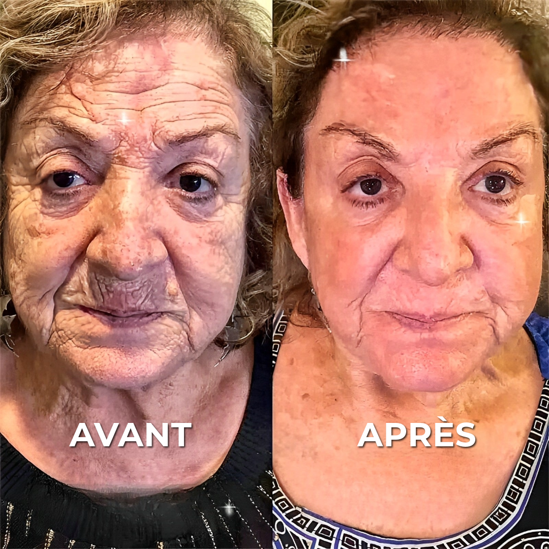 Crème Anti-Rides BOTOX™