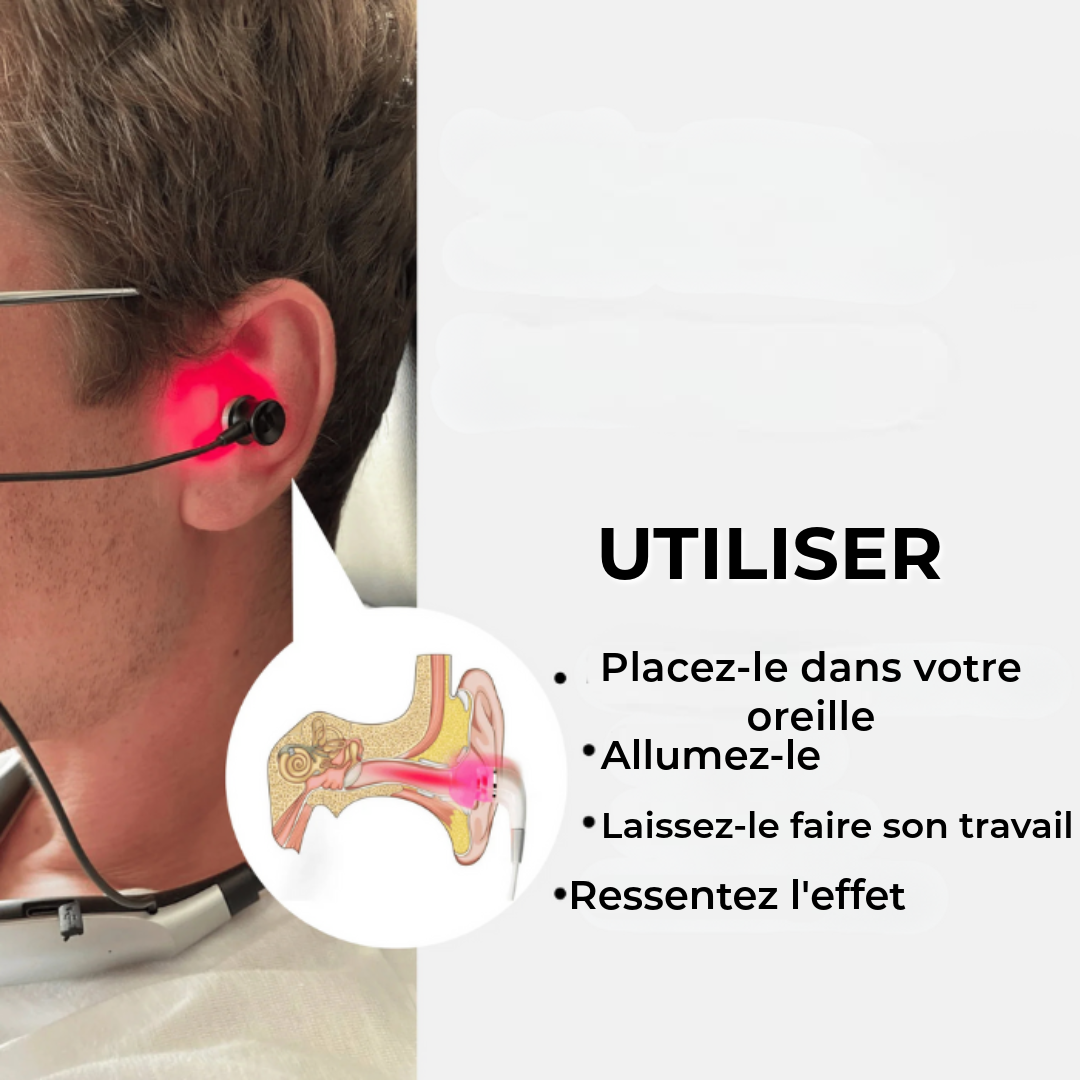 Thérapie au laser pour les acouphènes