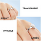 RingFix™ | réducteur de bague