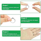 RingFix™ | réducteur de bague