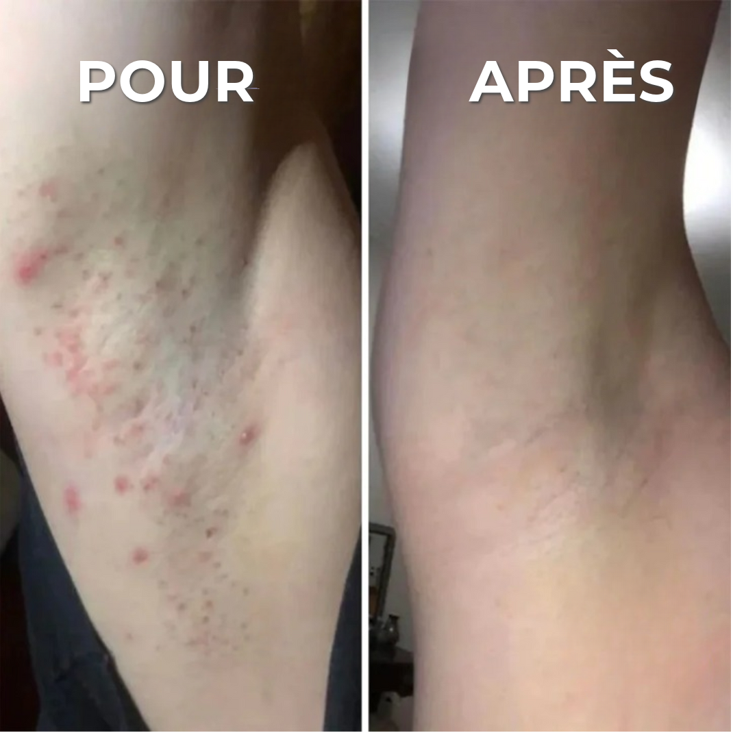 Rasoir professionnel anti-irritation