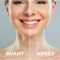 YouBuy™ | Poudre Blanchissante Professionnelle pour les Dents
