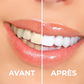 YouBuy™ | Poudre Blanchissante Professionnelle pour les Dents